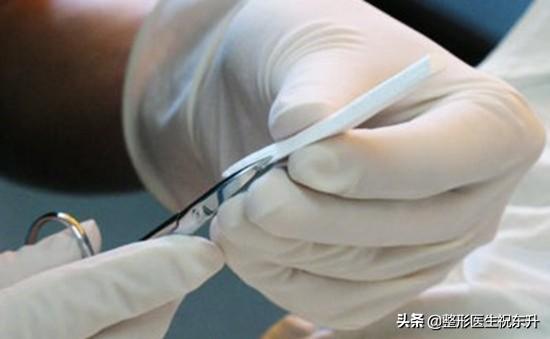 面部提拉可以改善泪沟嘛,做完面部提升手术