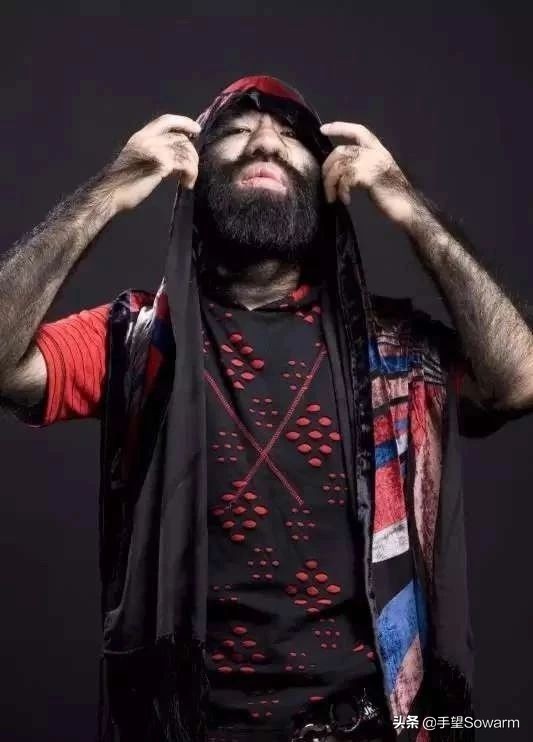 全世界体毛最多的人，是如何在歧视中逆袭为实力派歌手的？