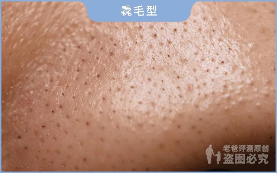 如何用简单的方法去黑头真实有效,别挤了教你去黑头的正确方法