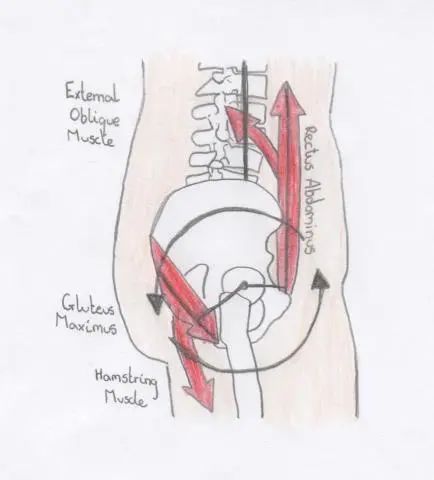 骶髂关节稳定性检查,怀孕后骶髂关节炎如何治疗