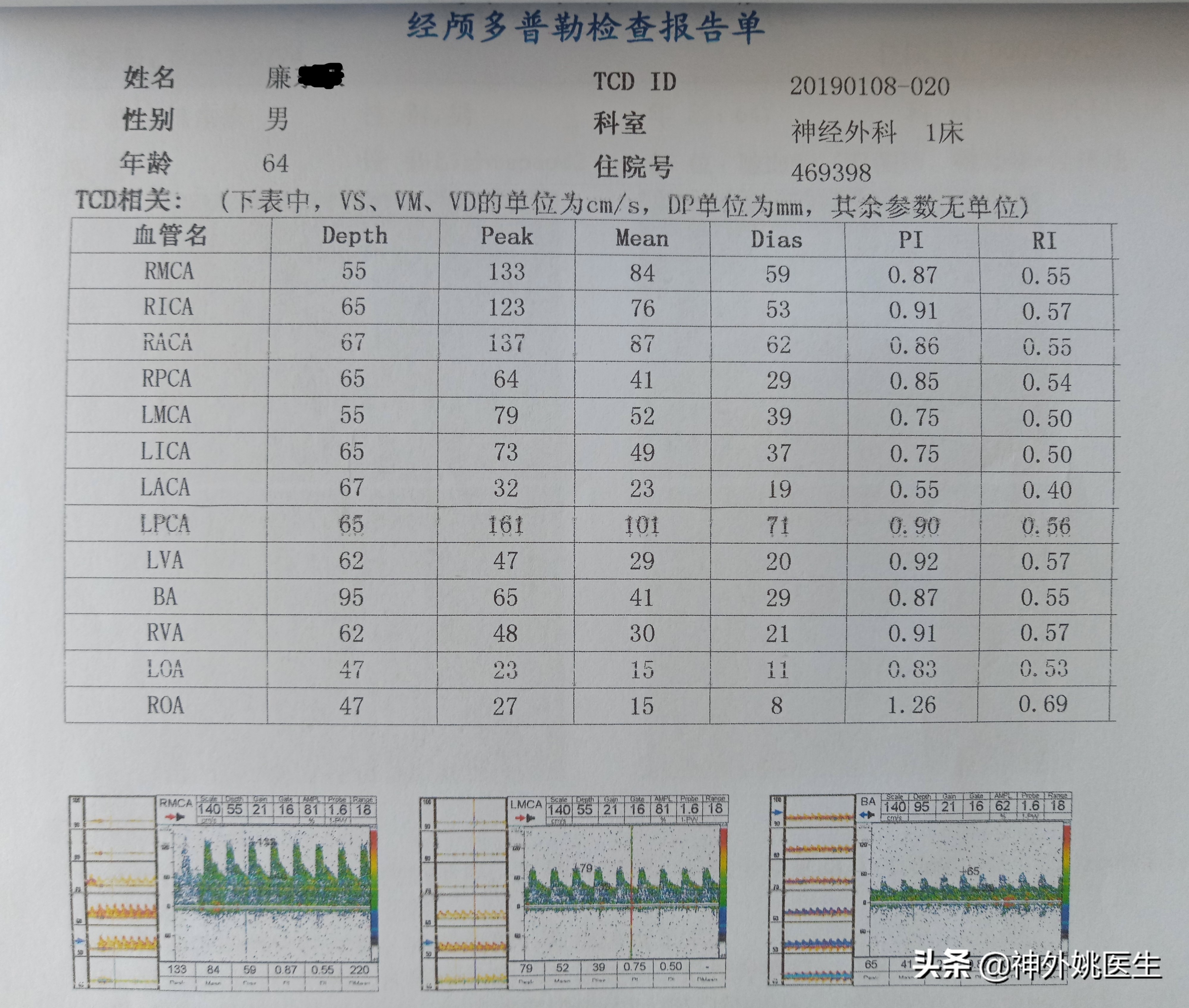 颈动脉狭窄的外科治疗