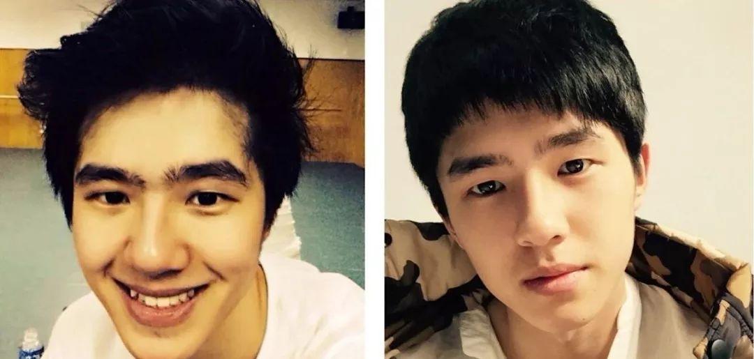 眉毛整容有几种方案,现在男生整容多吗