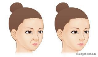 如何拯救暴瘦后的法令纹,不花钱怎么拯救法令纹