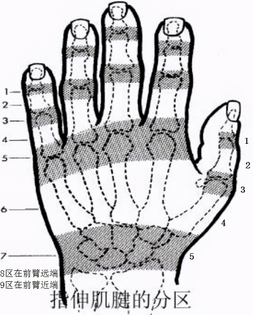 手指肌腱康复训练100个视频,手指肌腱术后康复训练最佳方法