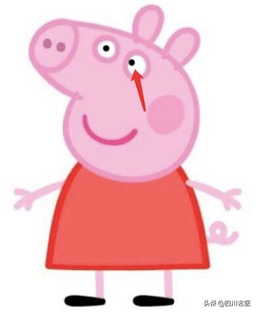 小孩弱视看东西歪头斜着看怎么办,孩子斜视看东西总歪头