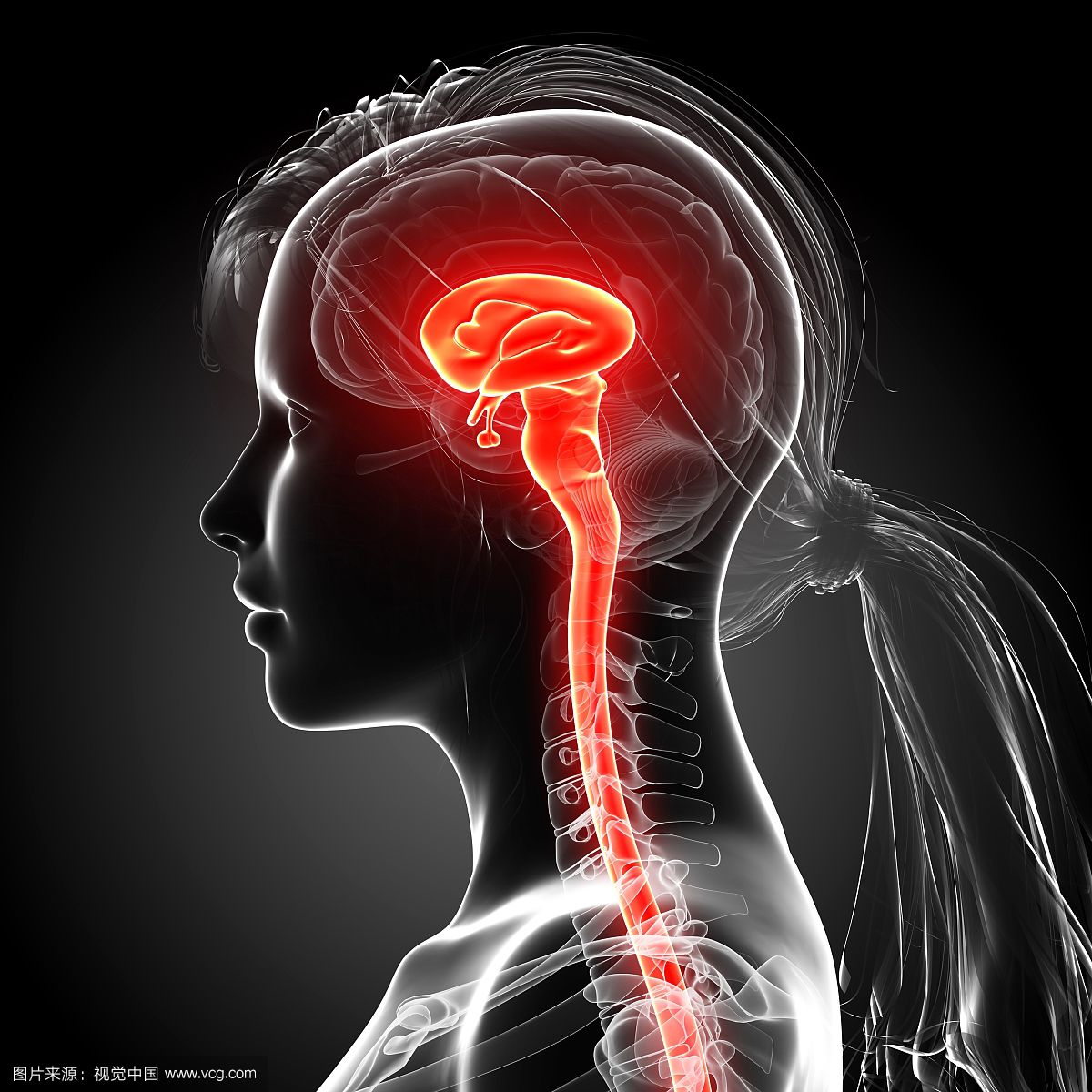 45岁脑干出血死亡父母怎么办,37岁脑干出血睁眼睛了