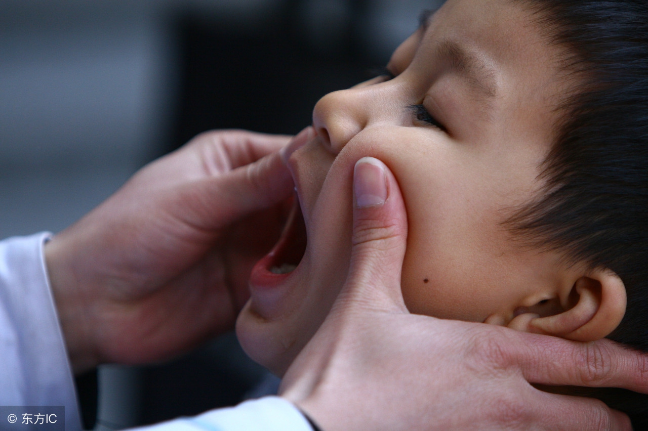 儿童手足口病发烧怎么治,儿童手足口病发热怎么办