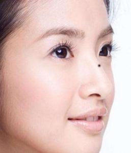 鼻子上长痣的女人好吗,女人右鼻子长痣好不好