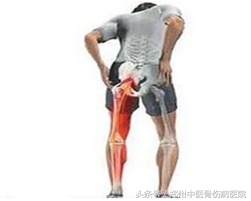 股骨头坏死与坐骨神经痛症状区别,股骨头坏死引起膝关节什么部位痛