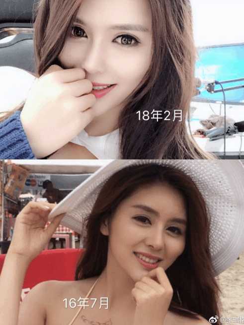 主播张琪格发图求证，节奏莫带了，真没整容！