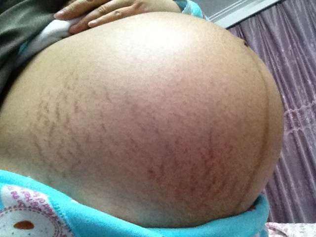 产前诊断为啥做全外显,产前医生说的问题