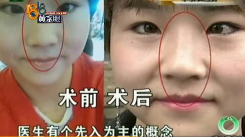 花了30万整的鼻子,花了10万整的鼻子