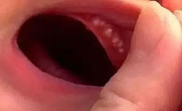 新生儿特有12个生理现象，统统都是正常的，爸妈不必太担心！