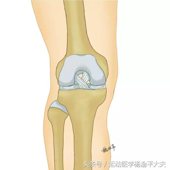 半月板撕裂手术缝两针多少钱,半月板撕裂缝1针