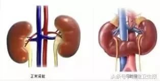 概率低于万分之一的事件,概率为几万分之一的事件