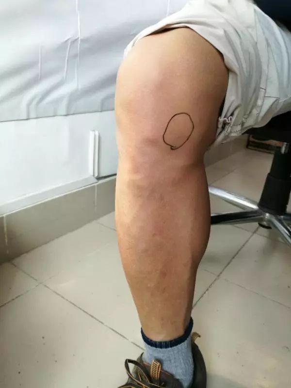 蔡赟毒舌解说,蔡赟说遗憾与警醒并存