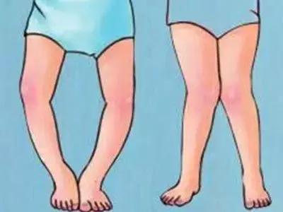 不管XO，轻松几个动作让你收获一双“维秘腿”！