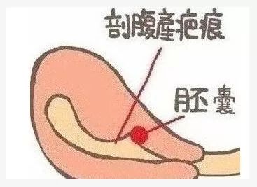 “赶紧流掉！越快越好！”嘉兴二胎妈妈被警告，这孩子像定时*弹炸**