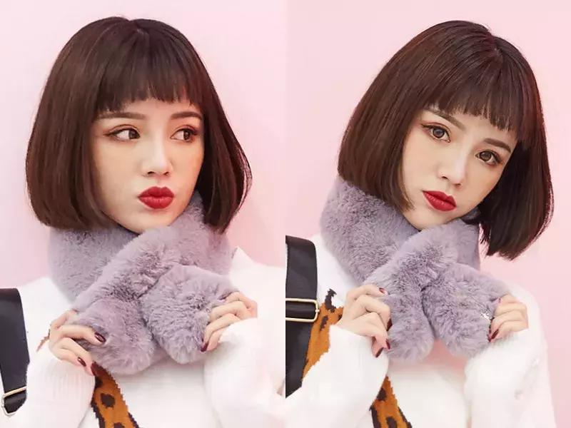 免费分享一个拯救发际线的方法,权威专家教你拯救发际线