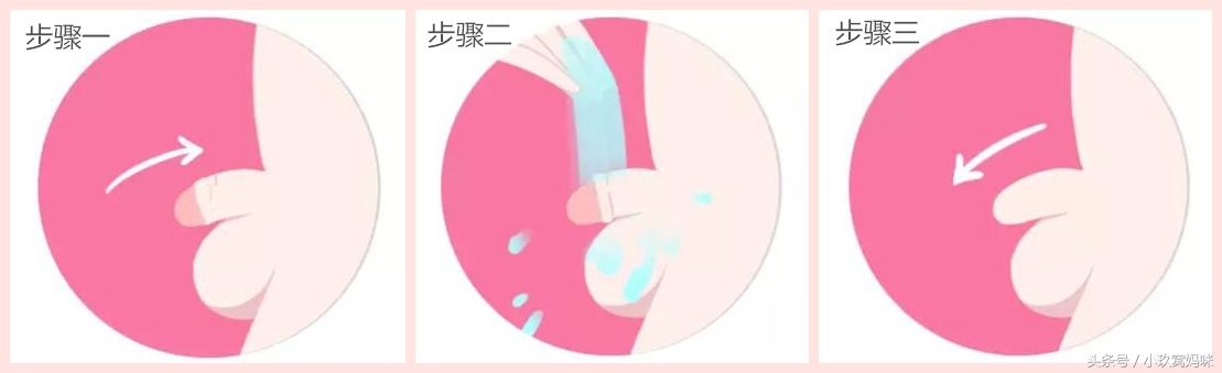 男宝宝私密护理注意事项,女宝宝护理的正确方法