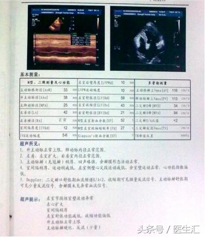 高龄心衰患者怎么做降压治疗?