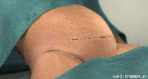 顺产压肚子痛还是剖腹产压肚子痛,剖腹产最主要应该就是压肚子疼吧