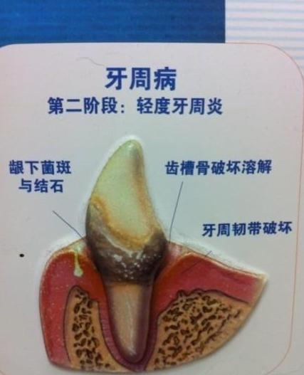 【宠物健康：涵姐说】狗狗牙齿以及常见问题简介