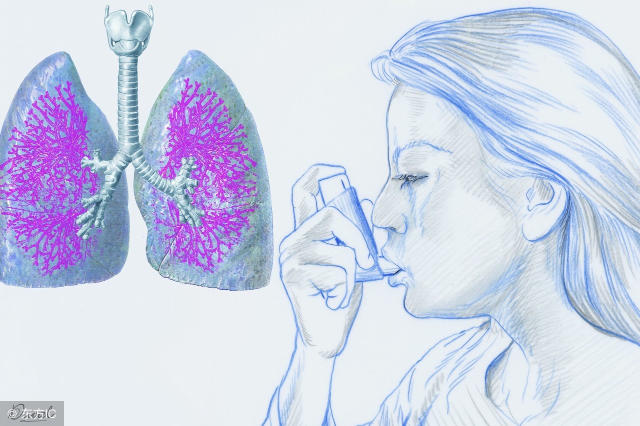 支气管扩张如何保养和预防,支气管扩张伴感染护理查房