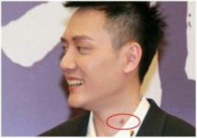 明星脖子上的“小草莓”太抢镜，赵薇甚至多次都能被拍到吻痕？