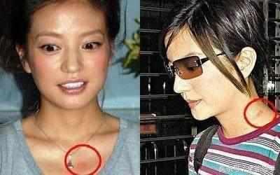 明星脖子上的“小草莓”太抢镜，赵薇甚至多次都能被拍到吻痕？