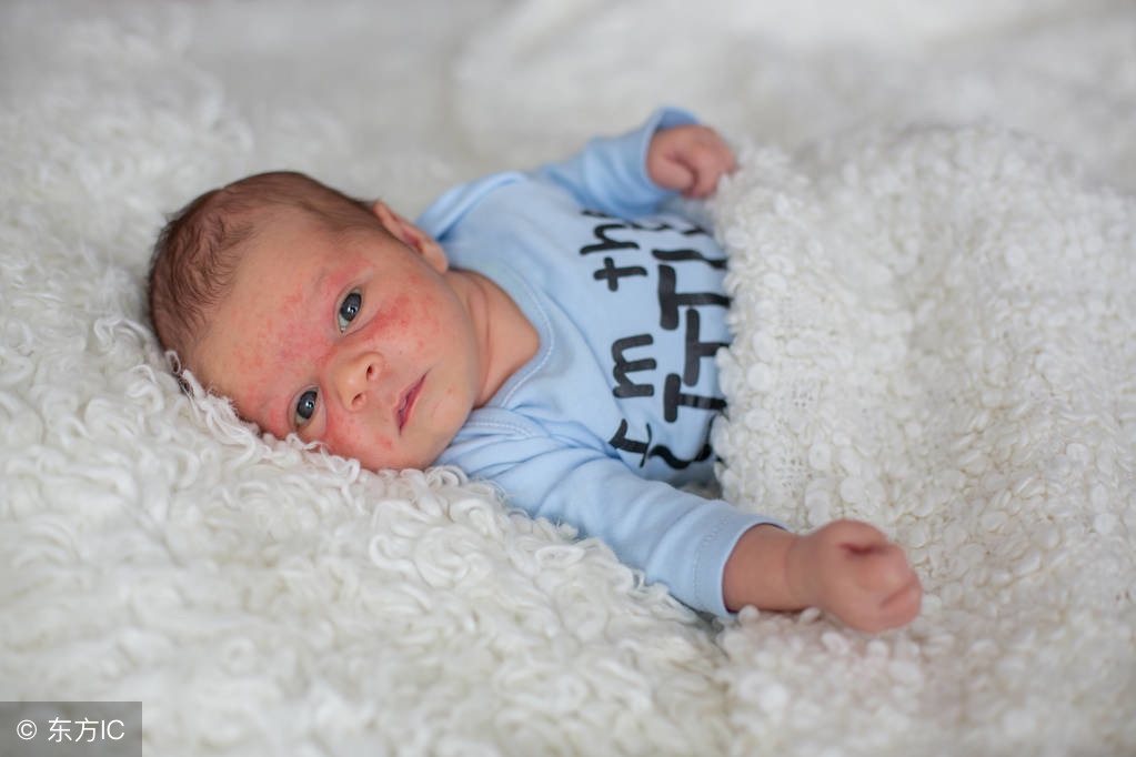 宝宝长湿疹原因,四个月的婴儿口水疹和湿疹的区别