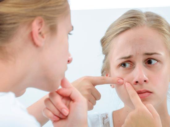 适合湿敷的去闭口的水推荐,一个星期祛闭口