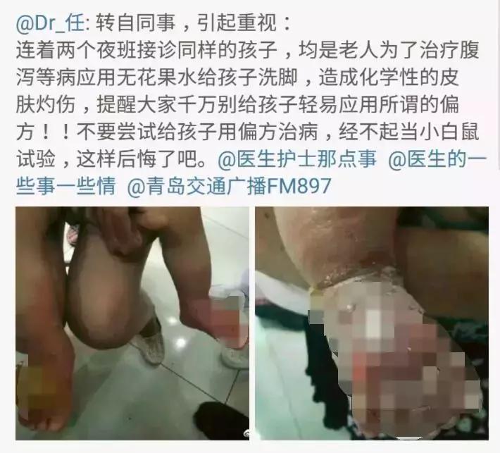 喂孩子吃活蝌蚪有哪些好处,喂孩子吃下活蝌蚪