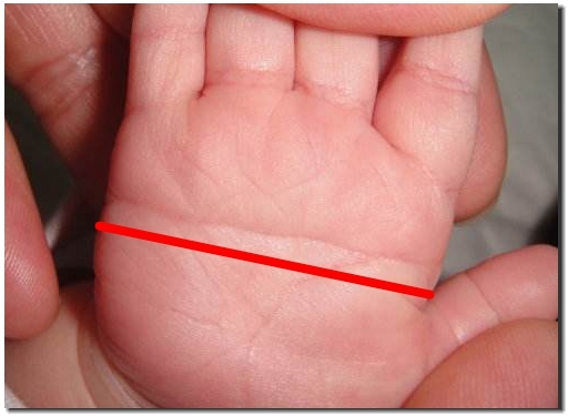 掌纹非常清晰还有很多小掌纹,掌纹突然出现大凶掌纹啥样