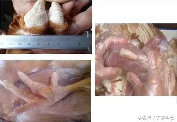 万病之源始于毒素,万病之源起于情志不畅