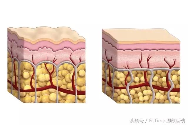 小肚腩瘦不下去怎么办,有肚腩怎么减掉小肚子呢图片