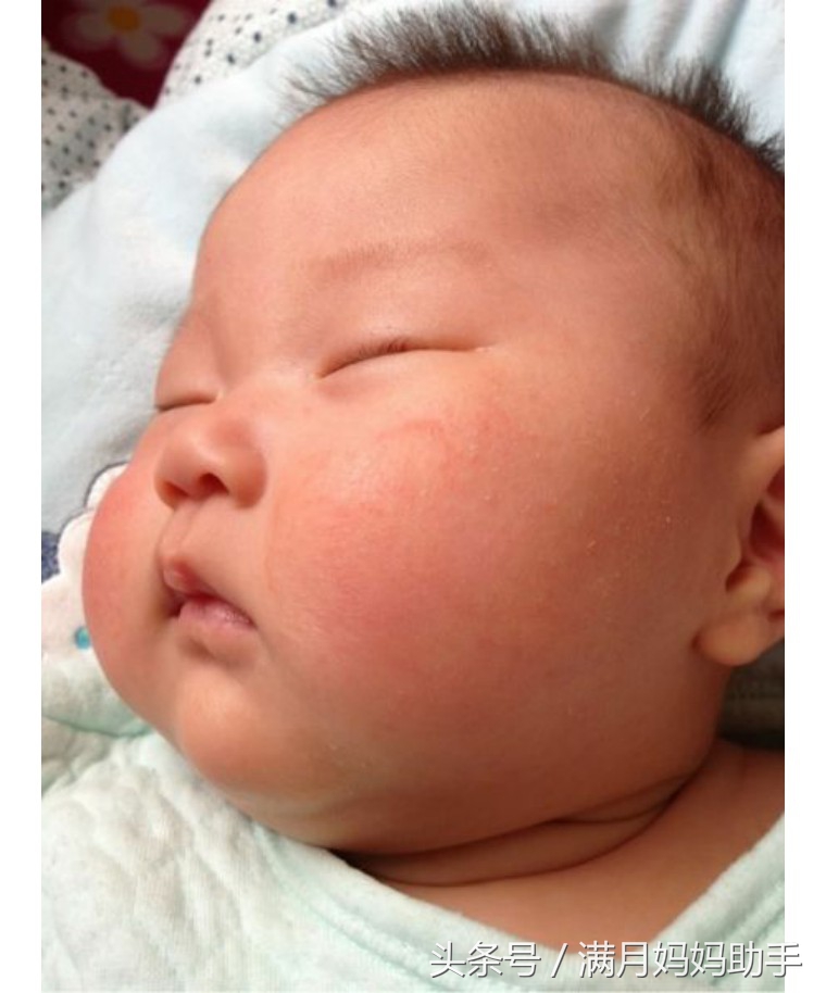 宝宝胳肢窝起红疹子什么原因,宝宝胳肢窝红图片