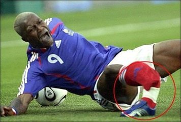 足球被爆头,足球守门员被爆头