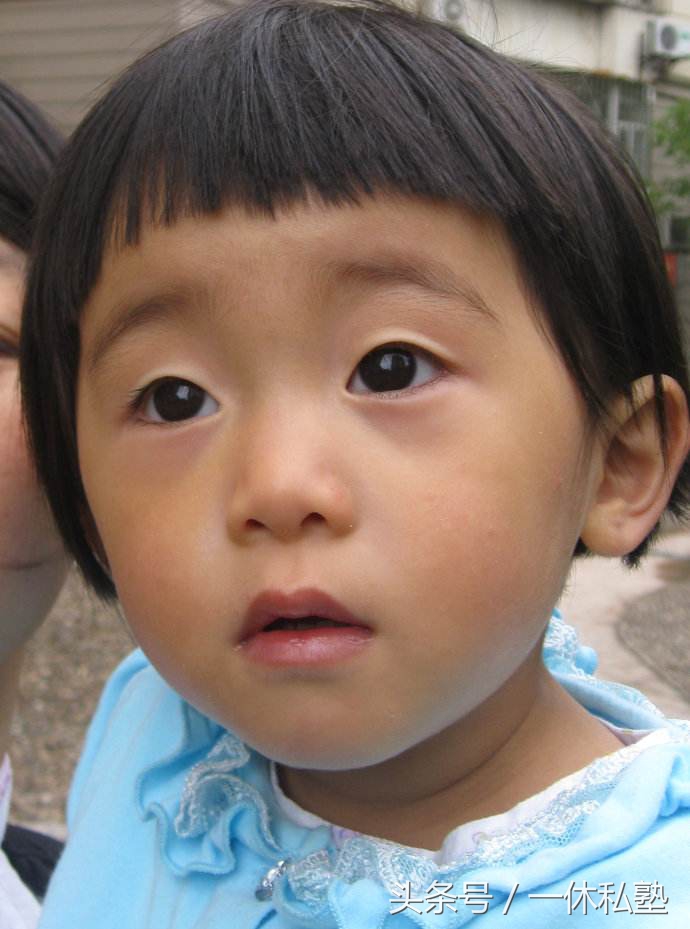 现在的孩子为什么都容易有黑眼圈,黑眼圈警告晚睡的小朋友