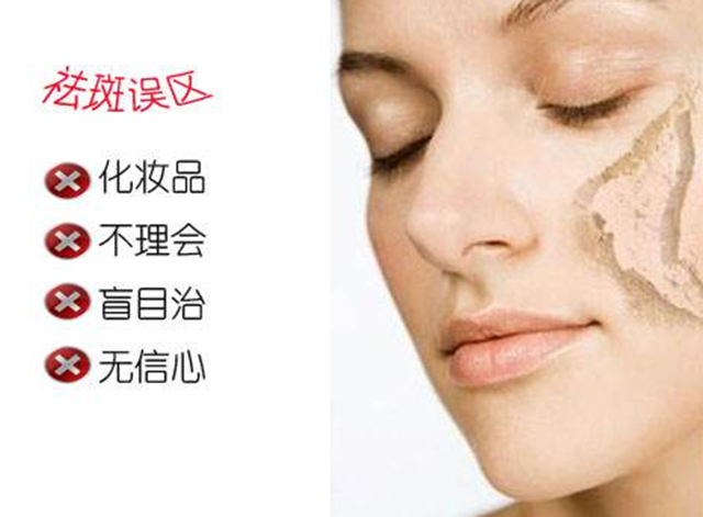 褐斑有几种,褐青色斑什么原因