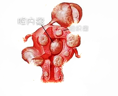 左小腹疼痛阴道流血是什么症状,小腹疼痛阴道流血是什么症状