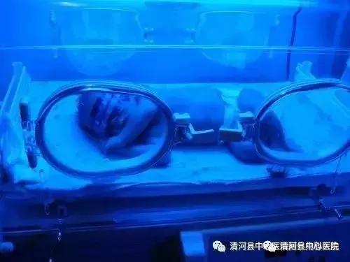 宝宝突然变黄,宝宝变黄是怎么回事