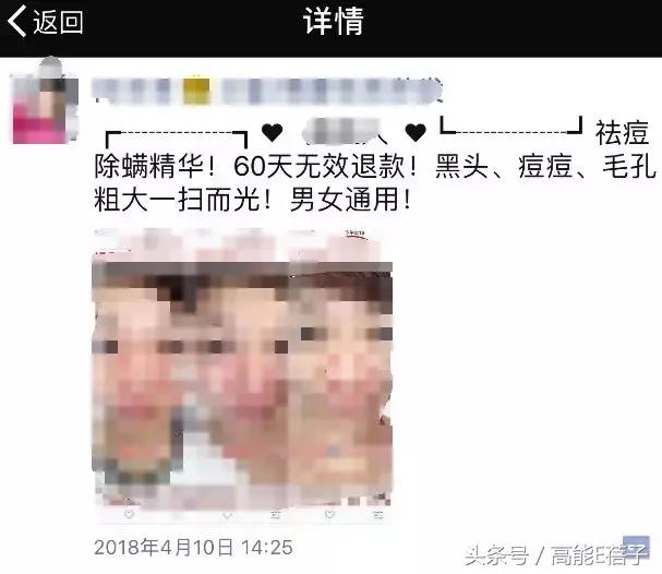 蔡徐坤、Angelababy都根治不掉的黑头，微商神器能去除？