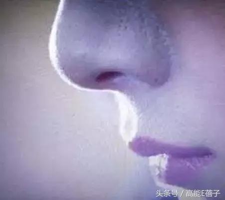 别傻了！蔡徐坤、Angelababy都根治不掉的黑头，微商神器能去除？