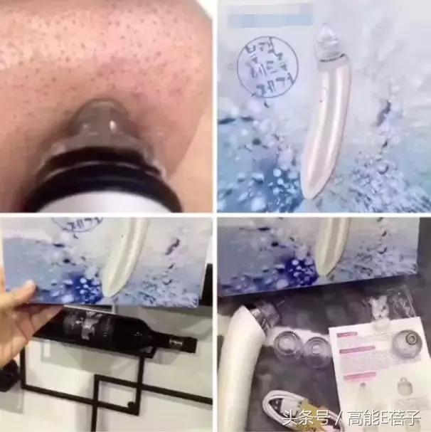 蔡徐坤、Angelababy都根治不掉的黑头，微商神器能去除？