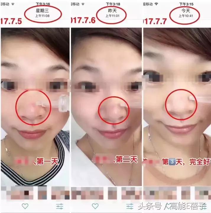 蔡徐坤angelababy2018,蔡徐坤用什么护肤