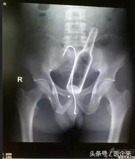 不可思议奇怪的东西,不可思议小物件穿透