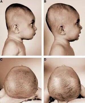 扁头的宝宝适合什么发型,宝宝头型扁头还是圆头好