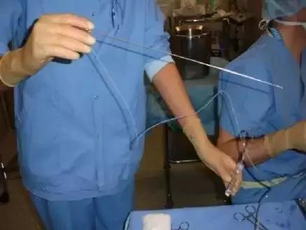 20岁女大学生捐卵,女大学生捐卵案