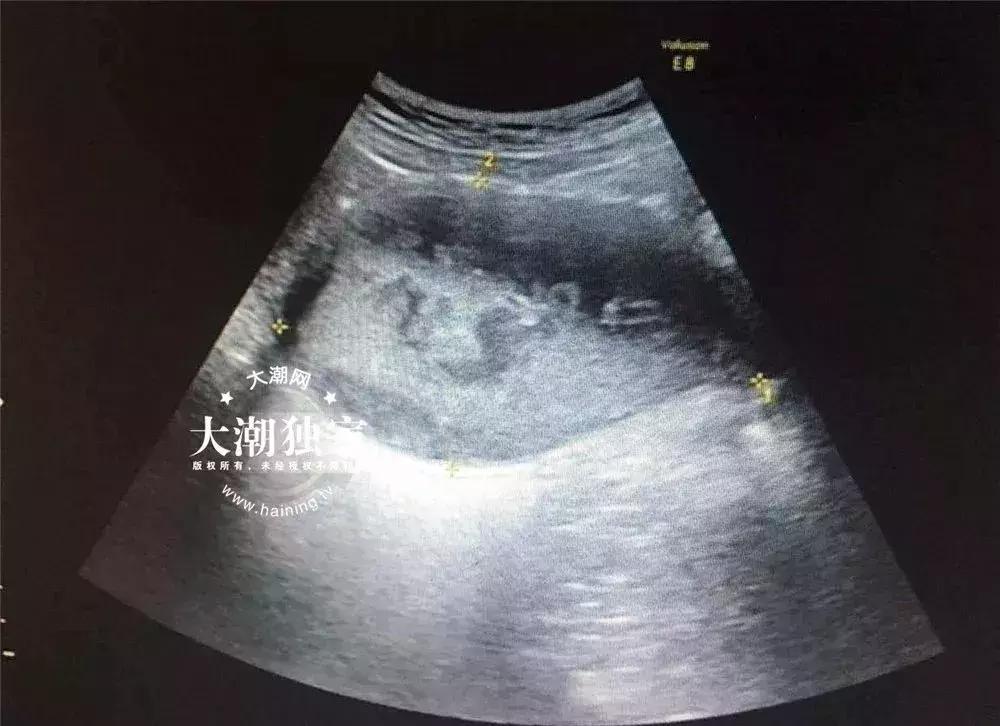 天天洗澡身体里散发臭味怎么回事,15岁女孩身体发出臭味